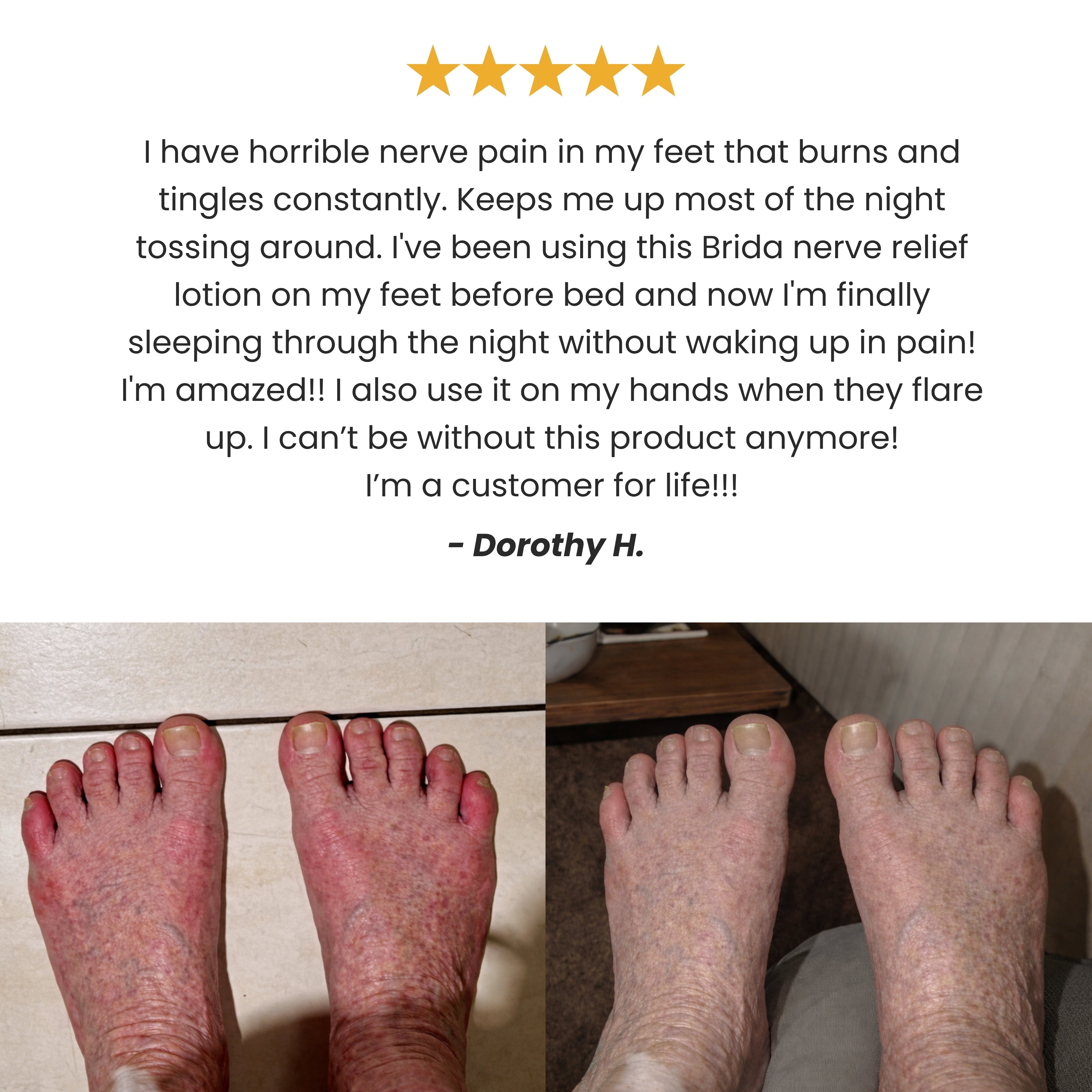 Brida Nerve Relief Lotion